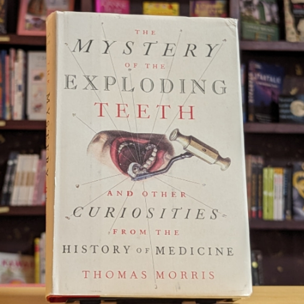The Mystery of the Exploding Teeth: And Other Curiosities from the History of Medicine